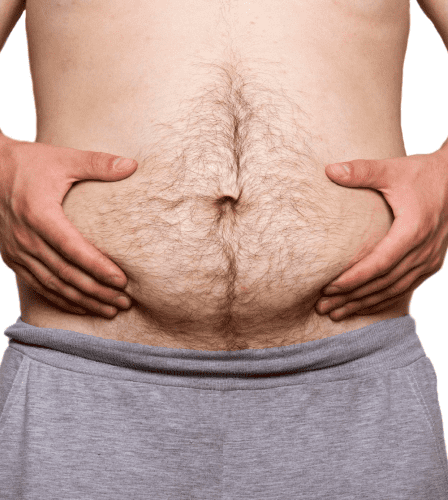 لیپوماتیک شکم در الو جراح 1