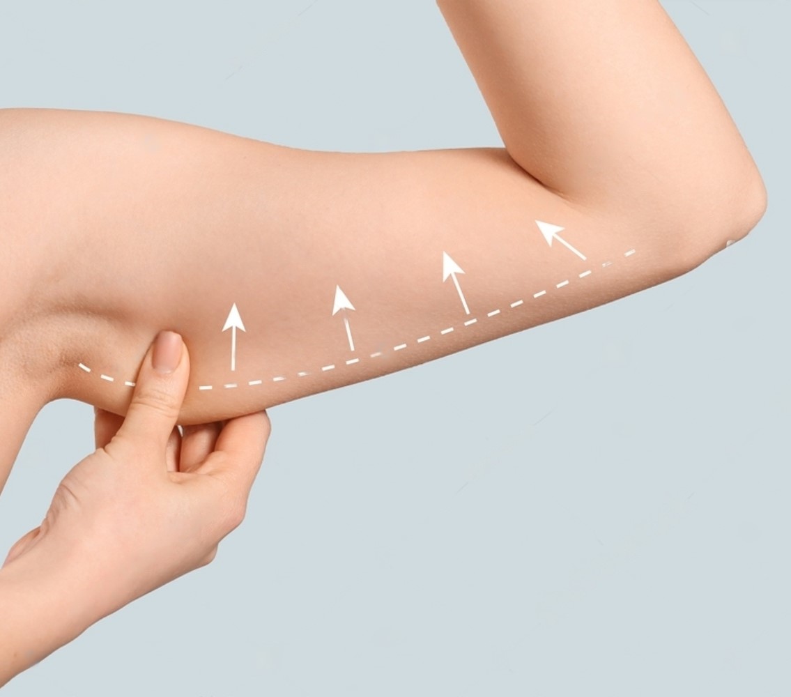 stock-photo-arm-of-young-woman-after-slimming-on-light-background-plastic-surgery-concept-2172284395-transformed