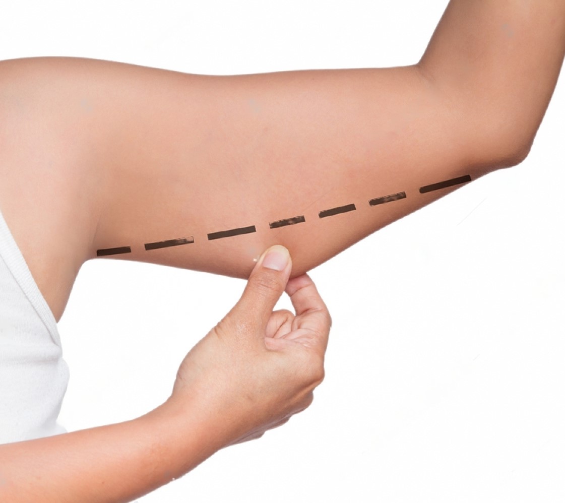 stock-photo-asian-woman-checking-her-upper-arm-486246634-transformed